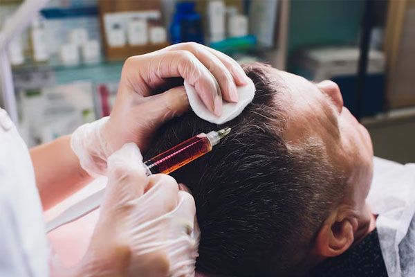L'uomo con problemi di calvizie riceve iniezioni