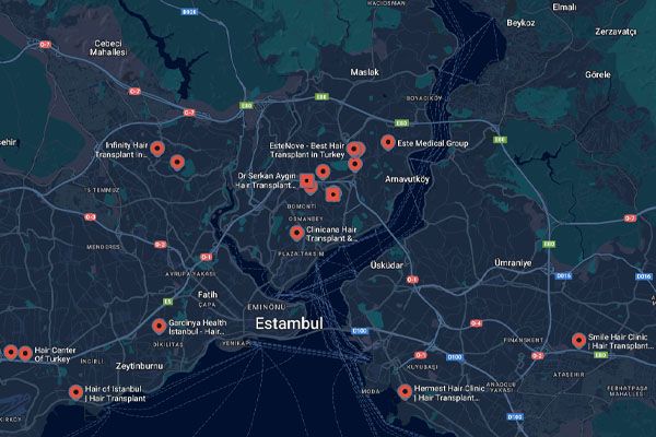 Mappa di Istanbul con localizzazione delle migliori cliniche trapianto capelli