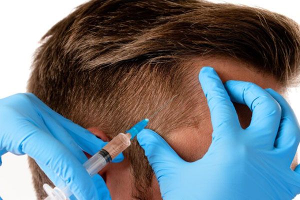 Primo piano della mano di un medico con una siringa e di un uomo che riceve un'iniezione - migliori cliniche trapianto capelli turchia