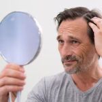 Trapianto di capelli e genetica