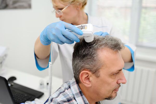 Uomo che cura i suoi problemi di calvizie