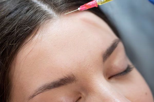 giovane donna che riceve un'iniezione - trapianto capelli è doloroso