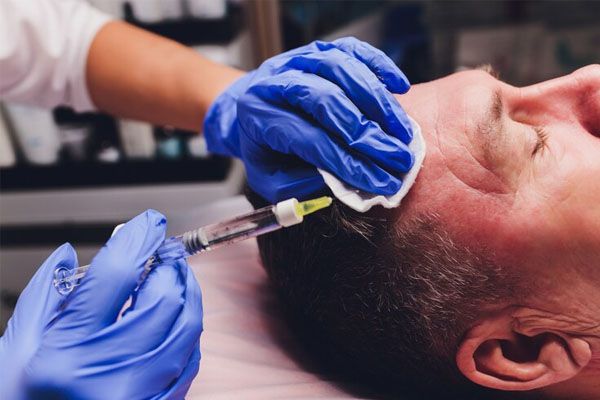 paziente sottoposto a trattamento per capelli
