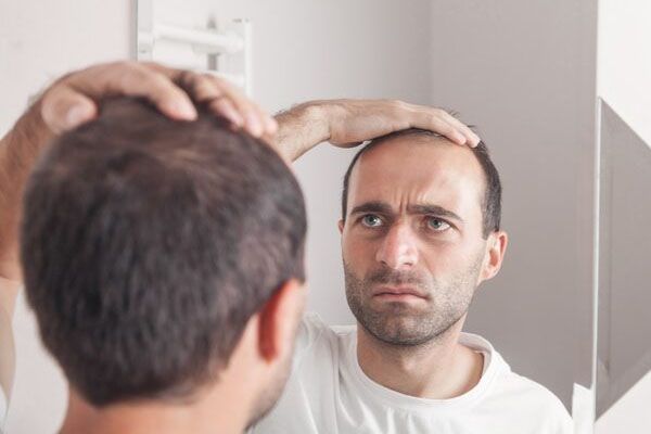 Uomo caucasico che guarda i capelli vicino allo specchio perdita di capelli - trapianto capelli Italia