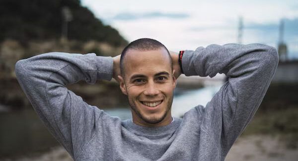 Trapianto di capelli nei minori di 30 anni