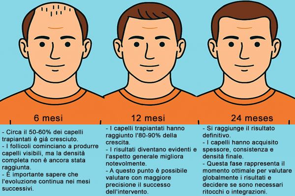 confronto-dellevoluzione-di-un-trapianto