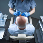 È vero che i trapianto di capelli lasciano cicatrici visibili