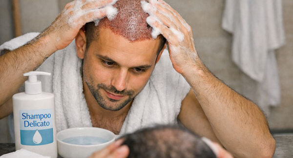 Quanto dura il periodo di adattamento dopo il trapianto di capelli