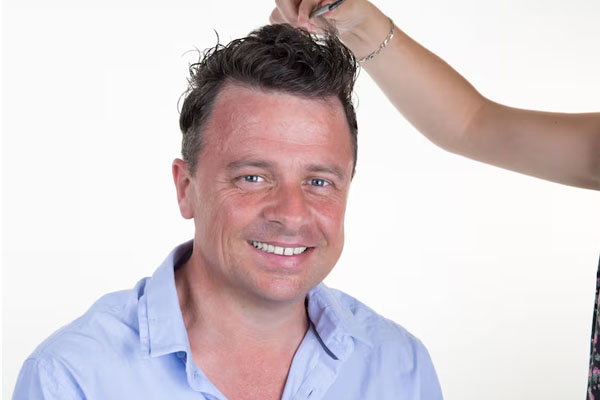 Ritratto ravvicinato di un uomo con una linea frontale densa e naturale, risultato di un trapianto combinato con cure mediche a lungo termine