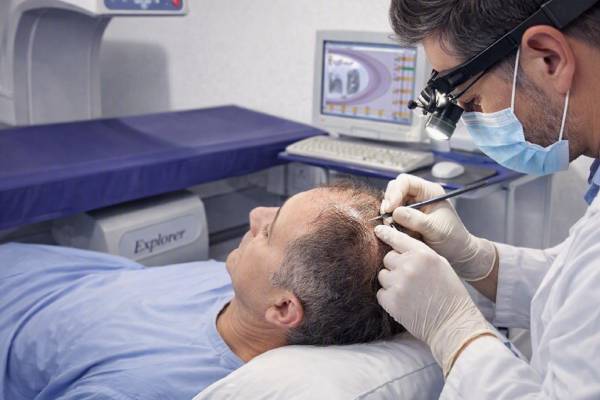 Procedura di trapianto di capelli senza rasatura eseguita da un medico esperto